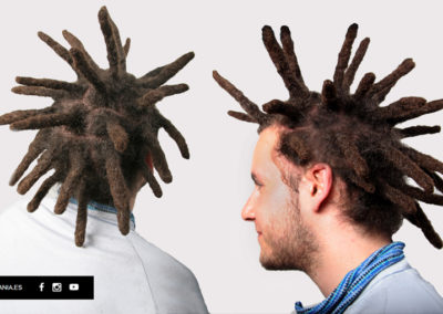 rastas gruesas